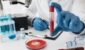 coronavirus-vaccine-composition-lab